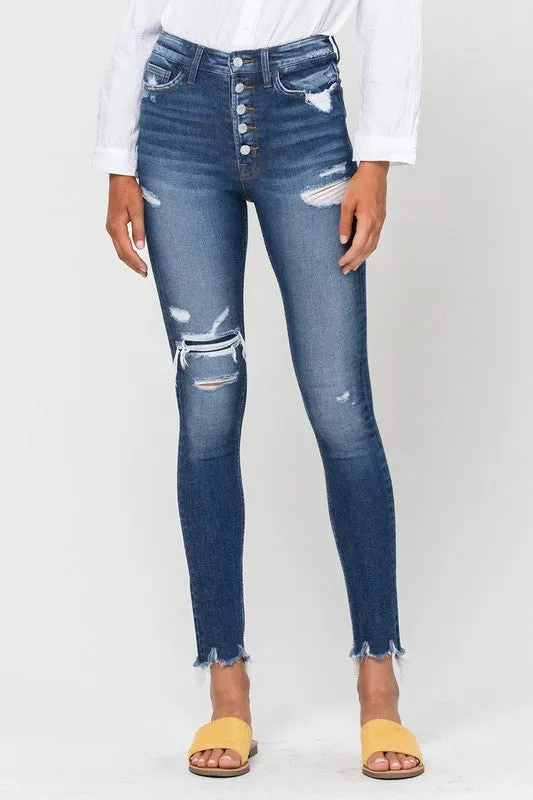 Sophie High Rise Patched Button Up Raw Hem Ankle Skinny